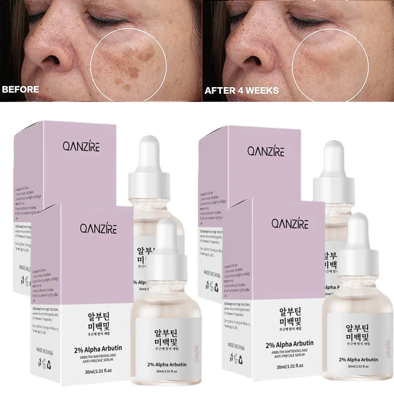 A0a794a2d38d045ae98dce1249ebd17cdq